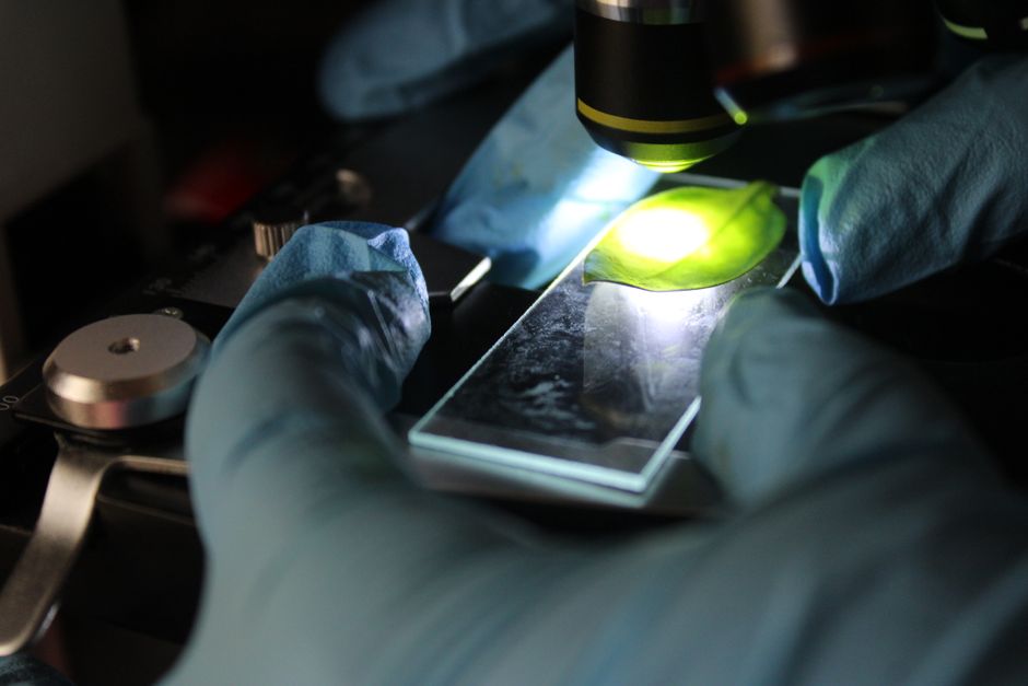 A gloved hand holding a glass slide under the lamp of a microscope.